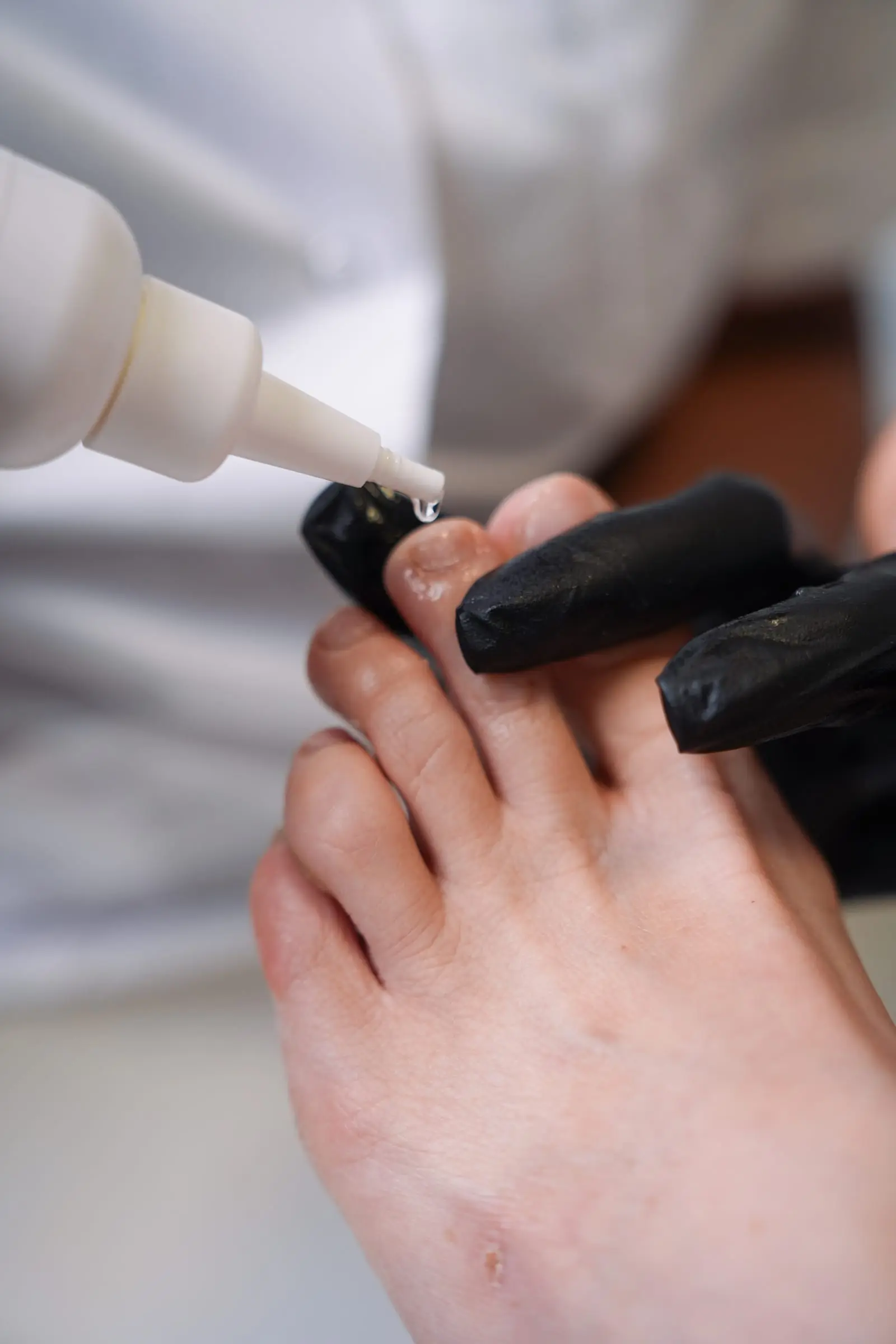 Een pedicure druppelt een product op een nagel, close-up met zwarte handschoenen.