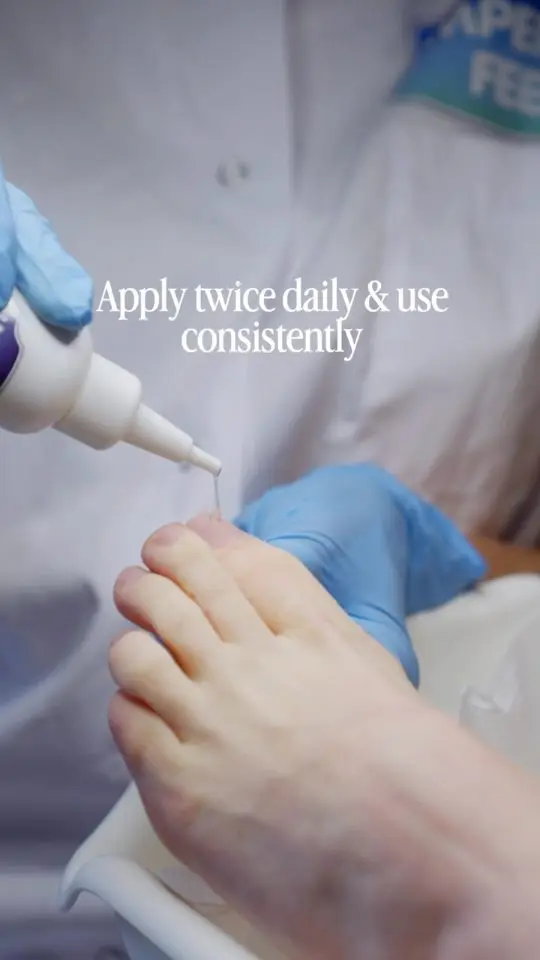 Reelcover van Imperial Feet: een voet wordt behandeld, met de tekst Apply twice daily and use consistently.